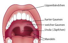 Lippen-/Zungenbändchen